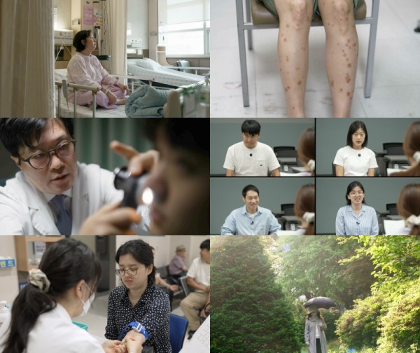 피부 면역의 중요성, EBS 특집 프로그램 방송 이미지