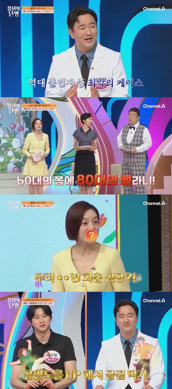 골다공증 위험 신호, 60세 도전자의 충격 골밀도 수치 이미지